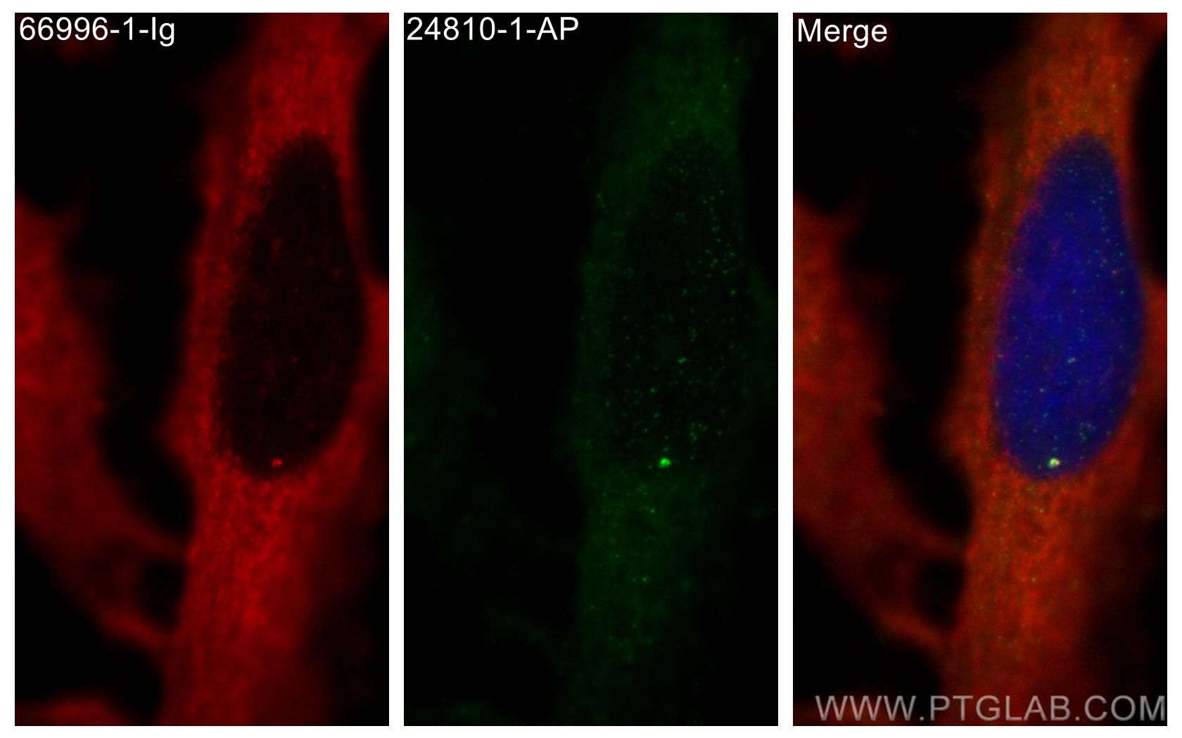 Immunofluorescence (IF) / fluorescent staining of HeLa cells using CEP128 Polyclonal antibody (24810-1-AP)