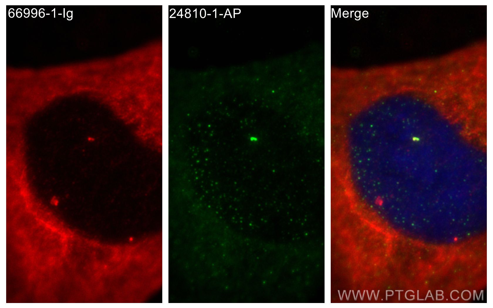 Immunofluorescence (IF) / fluorescent staining of HeLa cells using CEP128 Polyclonal antibody (24810-1-AP)