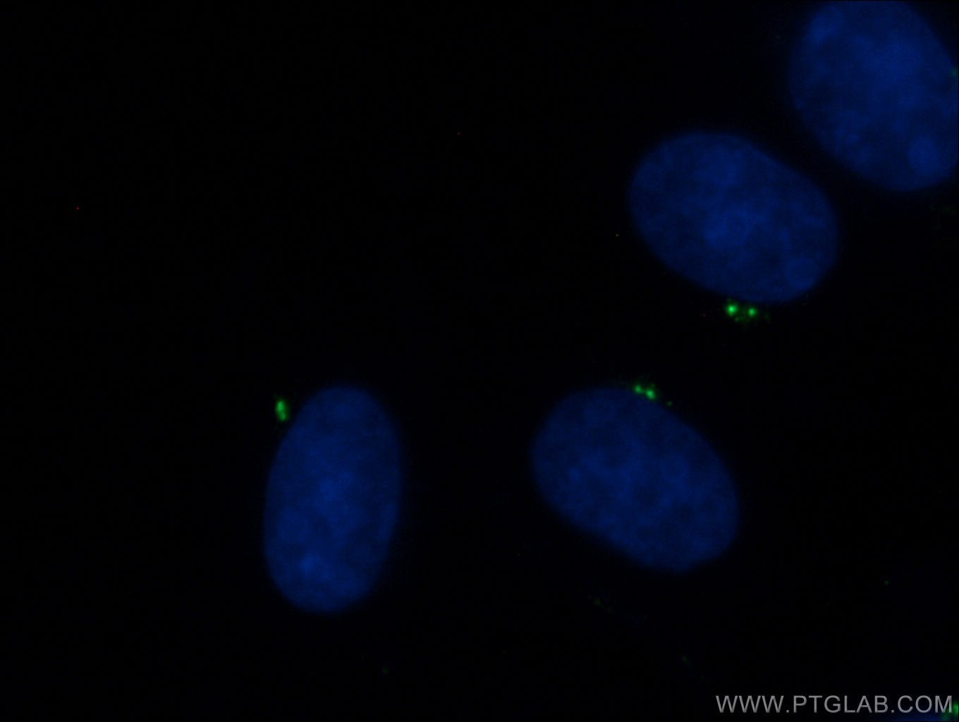 Immunofluorescence (IF) / fluorescent staining of MDCK cells using CEP135 Polyclonal antibody (24428-1-AP)