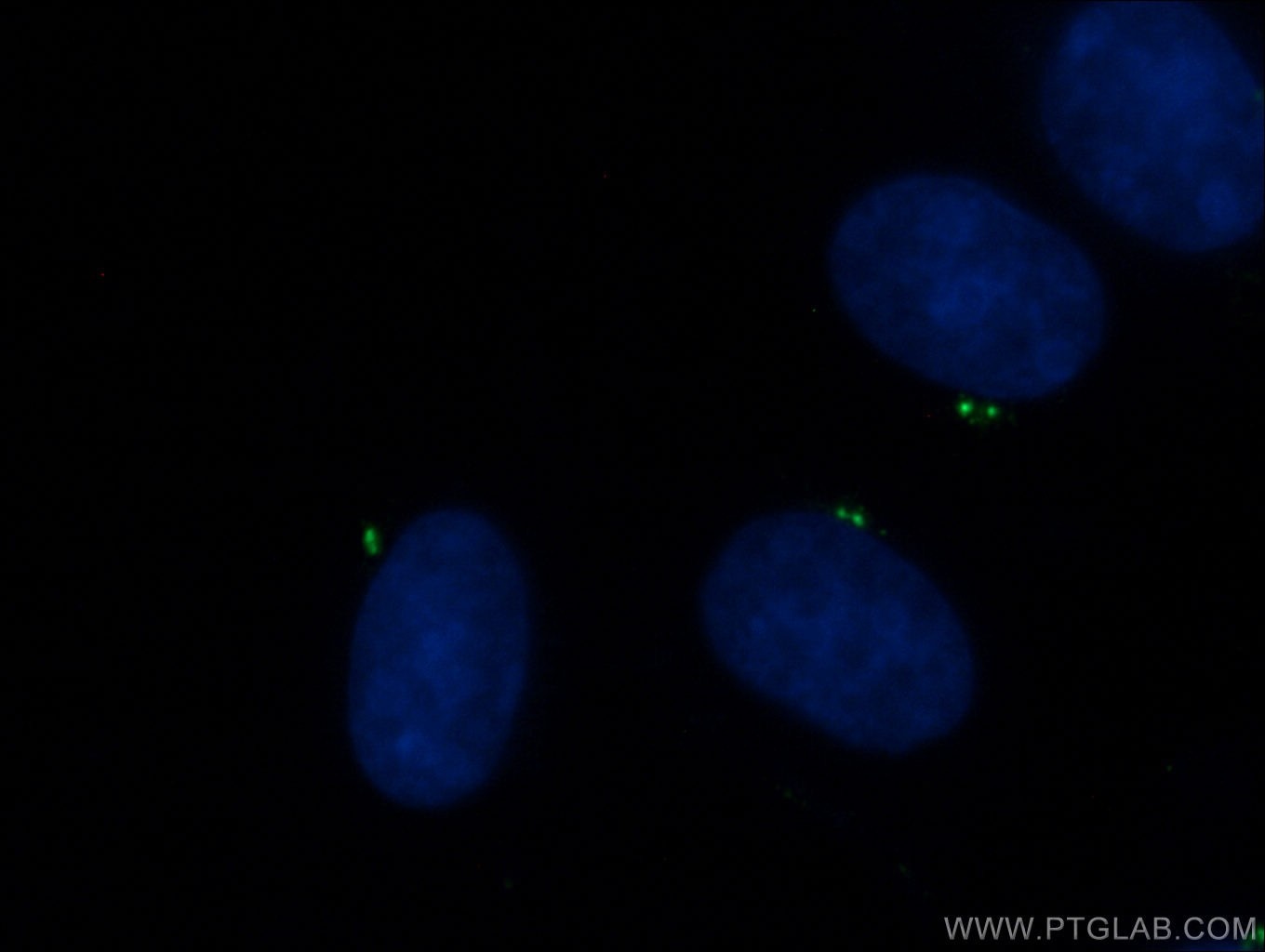 IF Staining of MDCK using 24428-1-AP