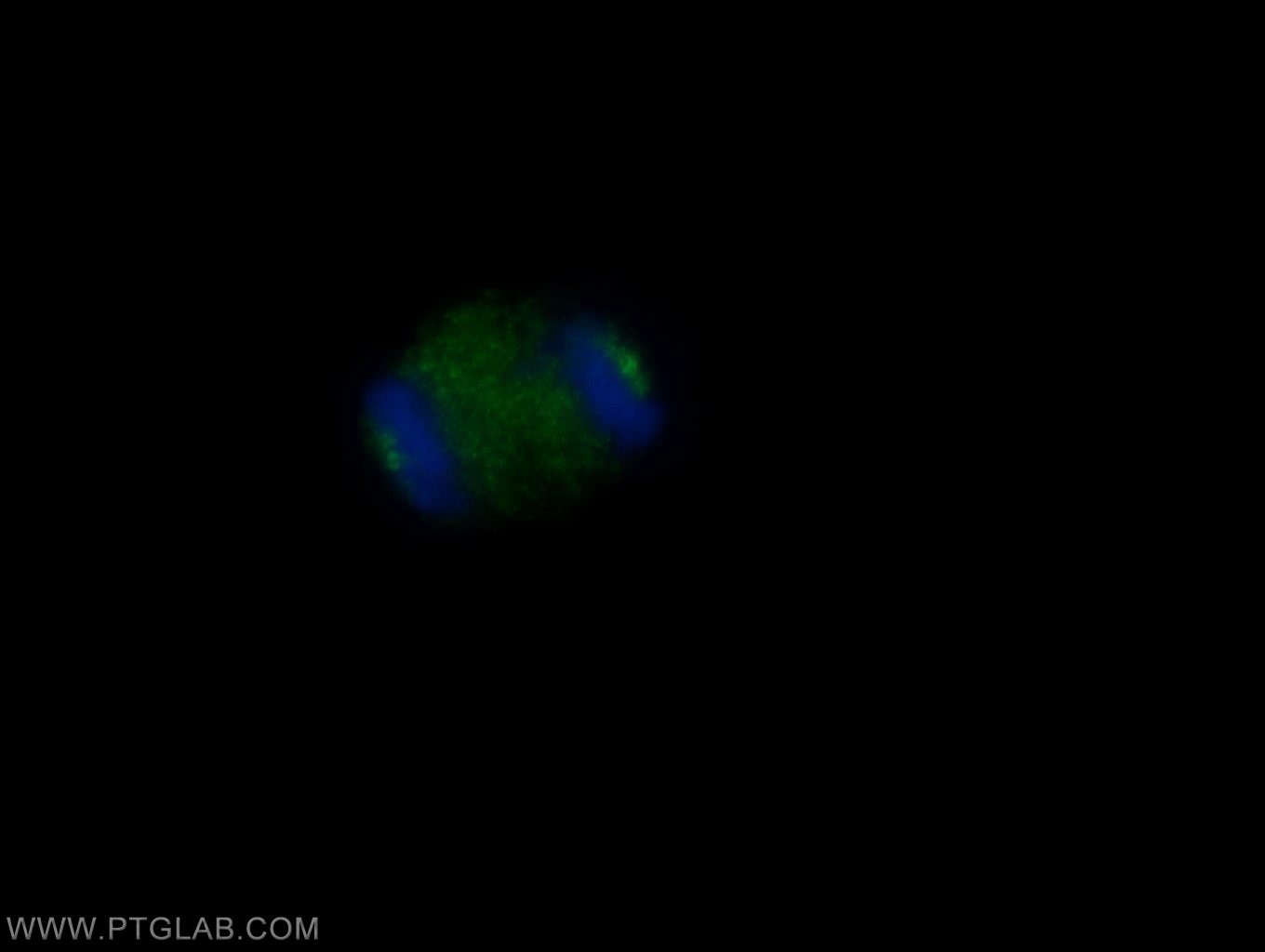 Immunofluorescence (IF) / fluorescent staining of MDCK cells using CEP135 Polyclonal antibody (24428-1-AP)