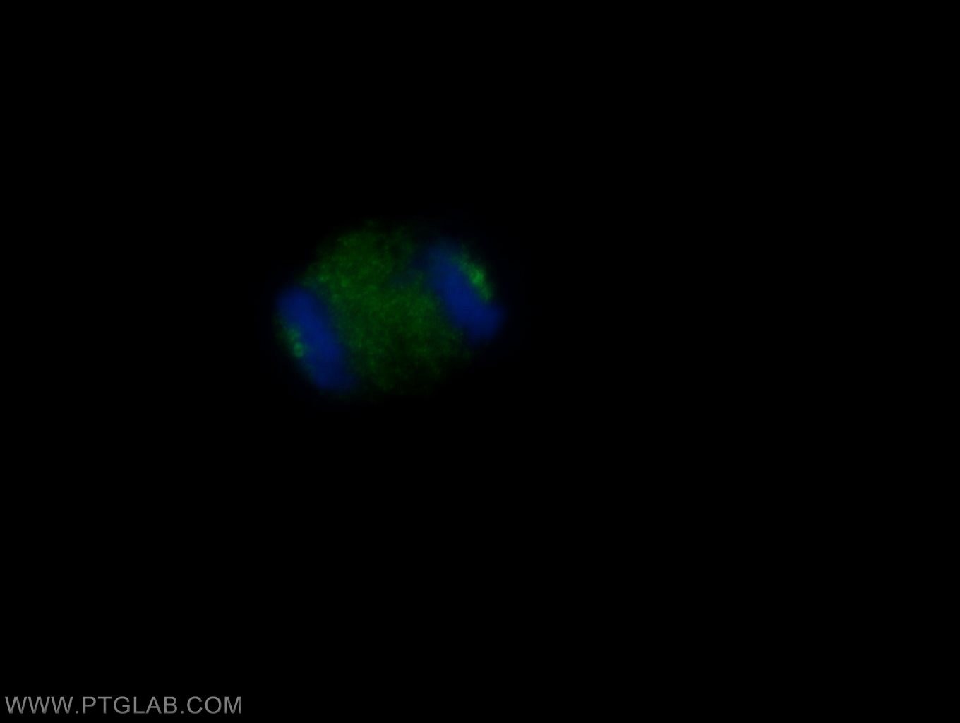 IF Staining of MDCK using 24428-1-AP