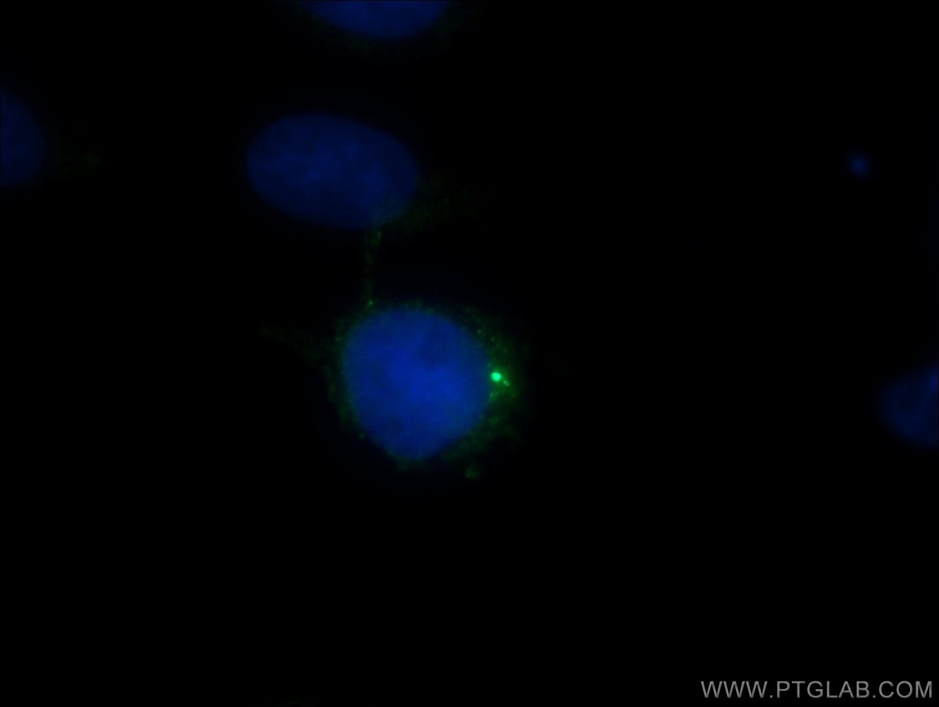 CEP135 Polyclonal antibody
