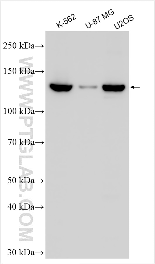 Western Blot (WB) analysis of various lysates using CEP135 Polyclonal antibody (24428-1-AP)