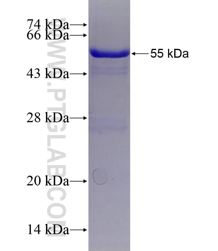 CEP135 fusion protein Ag18790 SDS-PAGE