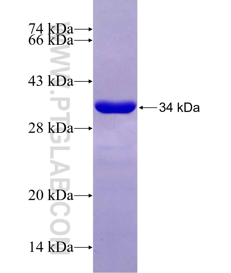 CEP135 fusion protein Ag19122 SDS-PAGE