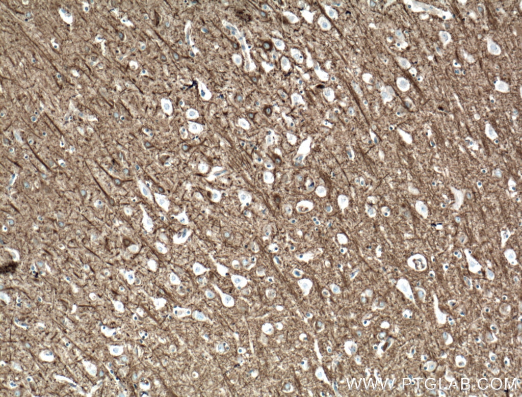 Immunohistochemistry (IHC) staining of human brain tissue using CEP152 Polyclonal antibody (21815-1-AP)