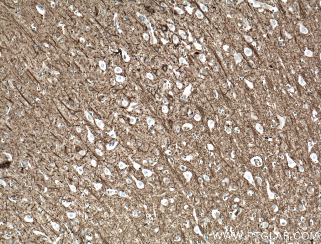 IHC staining of human brain using 21815-1-AP