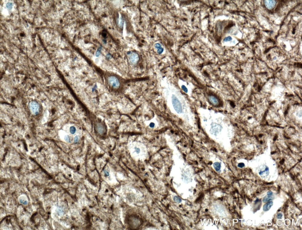 Immunohistochemistry (IHC) staining of human brain tissue using CEP152 Polyclonal antibody (21815-1-AP)