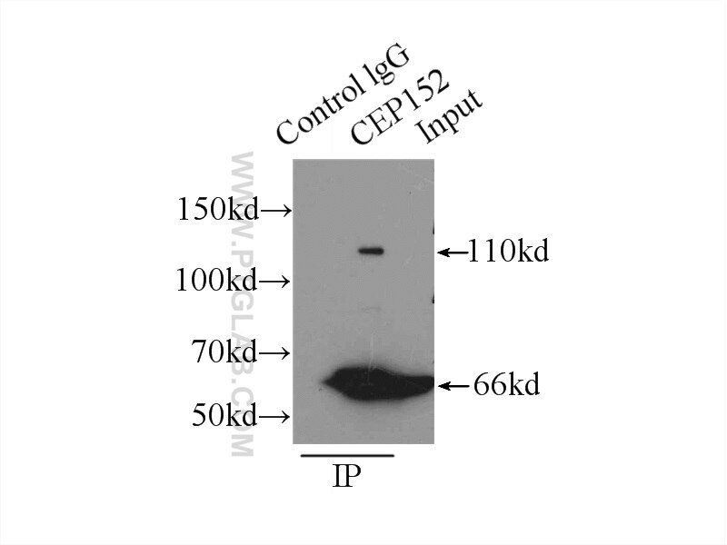 Immunoprecipitation (IP) experiment of mouse brain tissue using CEP152 Polyclonal antibody (21815-1-AP)