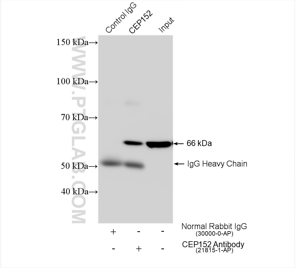 Immunoprecipitation (IP) experiment of mouse brain tissue using CEP152 Polyclonal antibody (21815-1-AP)