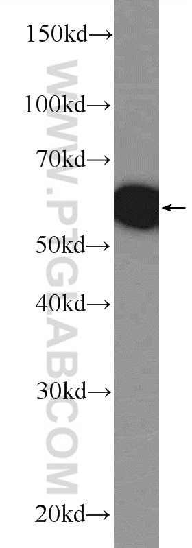 Western Blot (WB) analysis of mouse brain tissue using CEP152 Polyclonal antibody (21815-1-AP)