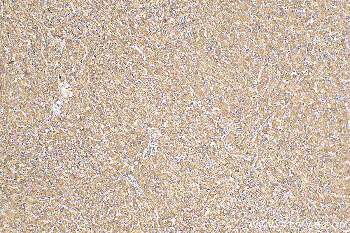 Immunohistochemistry (IHC) staining of human liver tissue using CEP162 Polyclonal antibody (30210-1-AP)