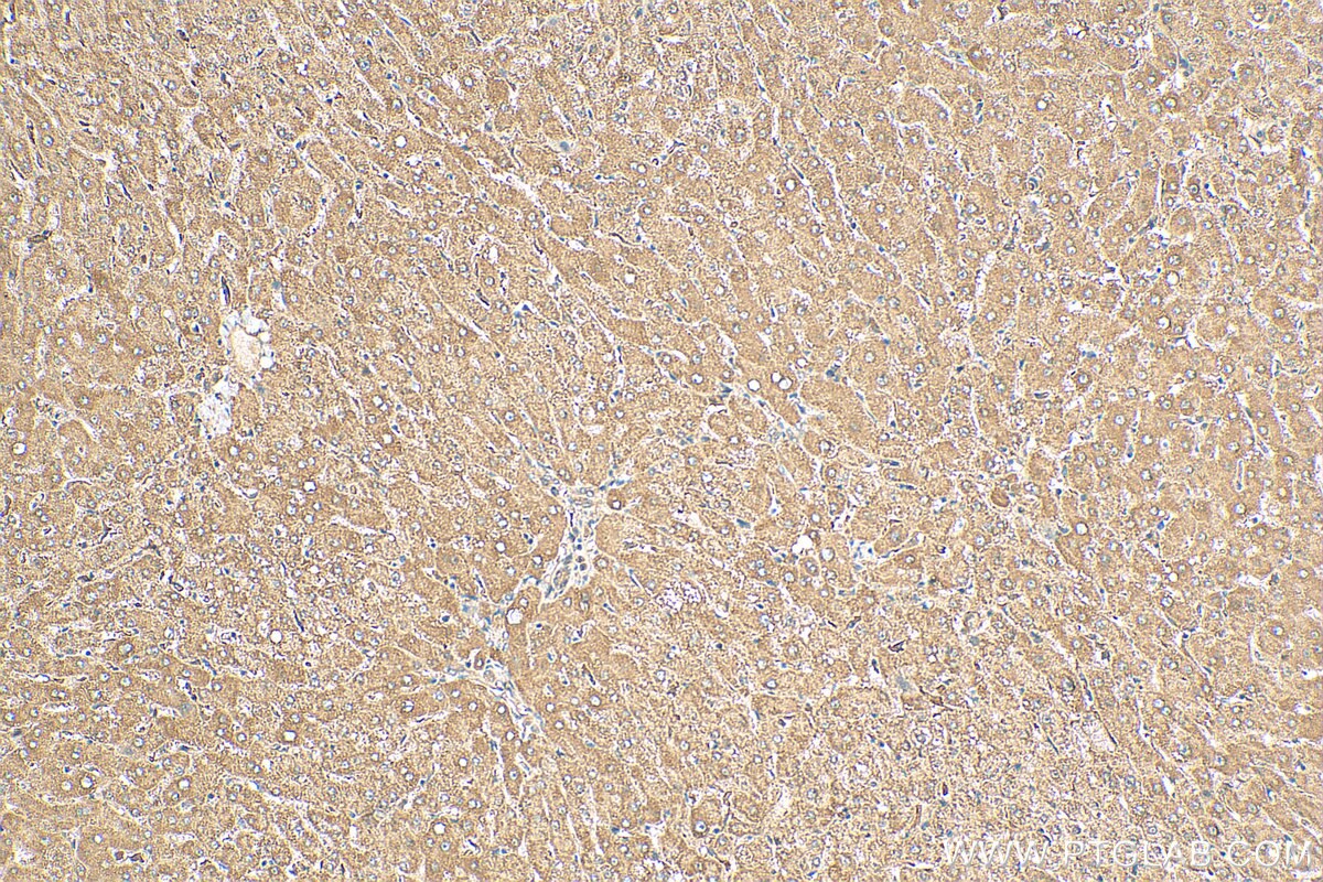 IHC staining of human liver using 30210-1-AP