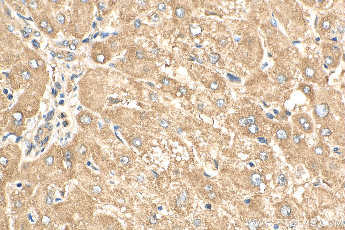 IHC staining of human liver using 30210-1-AP