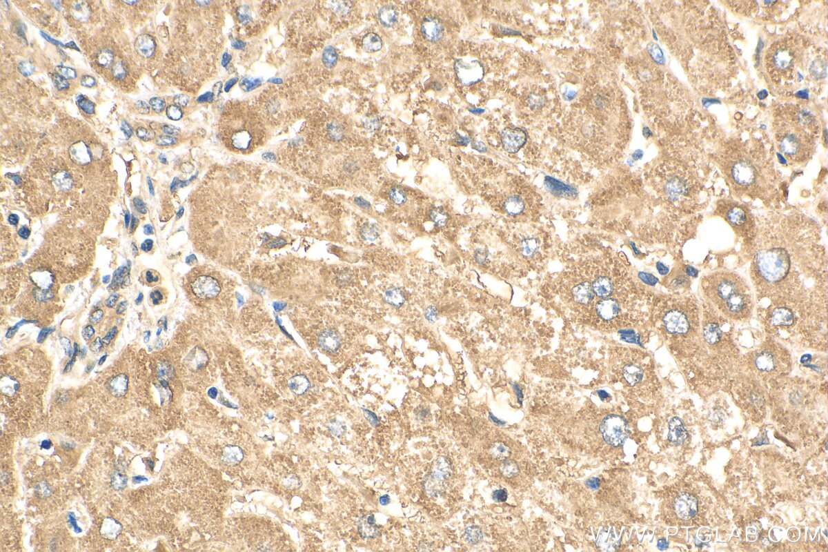 Immunohistochemistry (IHC) staining of human liver tissue using CEP162 Polyclonal antibody (30210-1-AP)