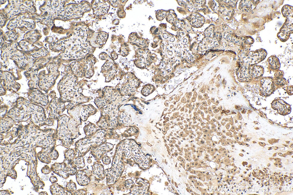 Immunohistochemistry (IHC) staining of human placenta tissue using CEP162 Polyclonal antibody (30210-1-AP)