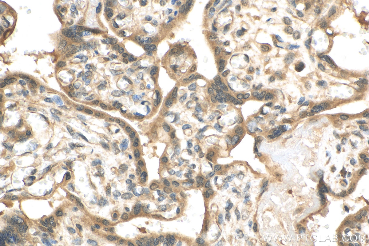 Immunohistochemistry (IHC) staining of human placenta tissue using CEP162 Polyclonal antibody (30210-1-AP)