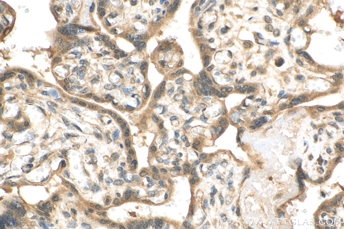 IHC staining of human placenta using 30210-1-AP