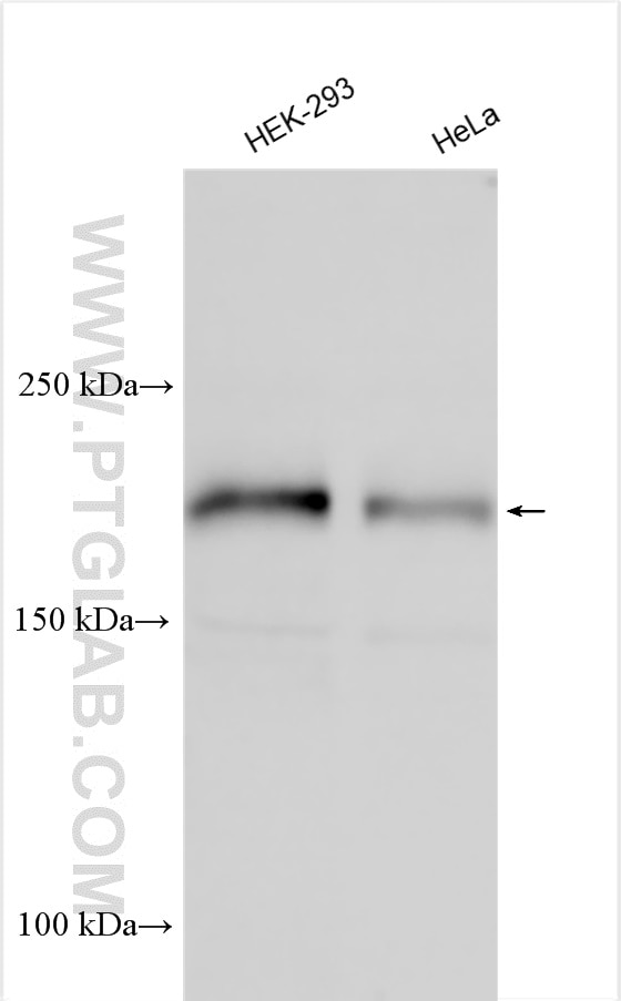 Western Blot (WB) analysis of various lysates using CEP162 Polyclonal antibody (30210-1-AP)