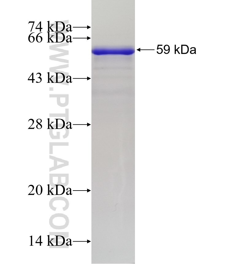 CEP162 fusion protein Ag32953 SDS-PAGE
