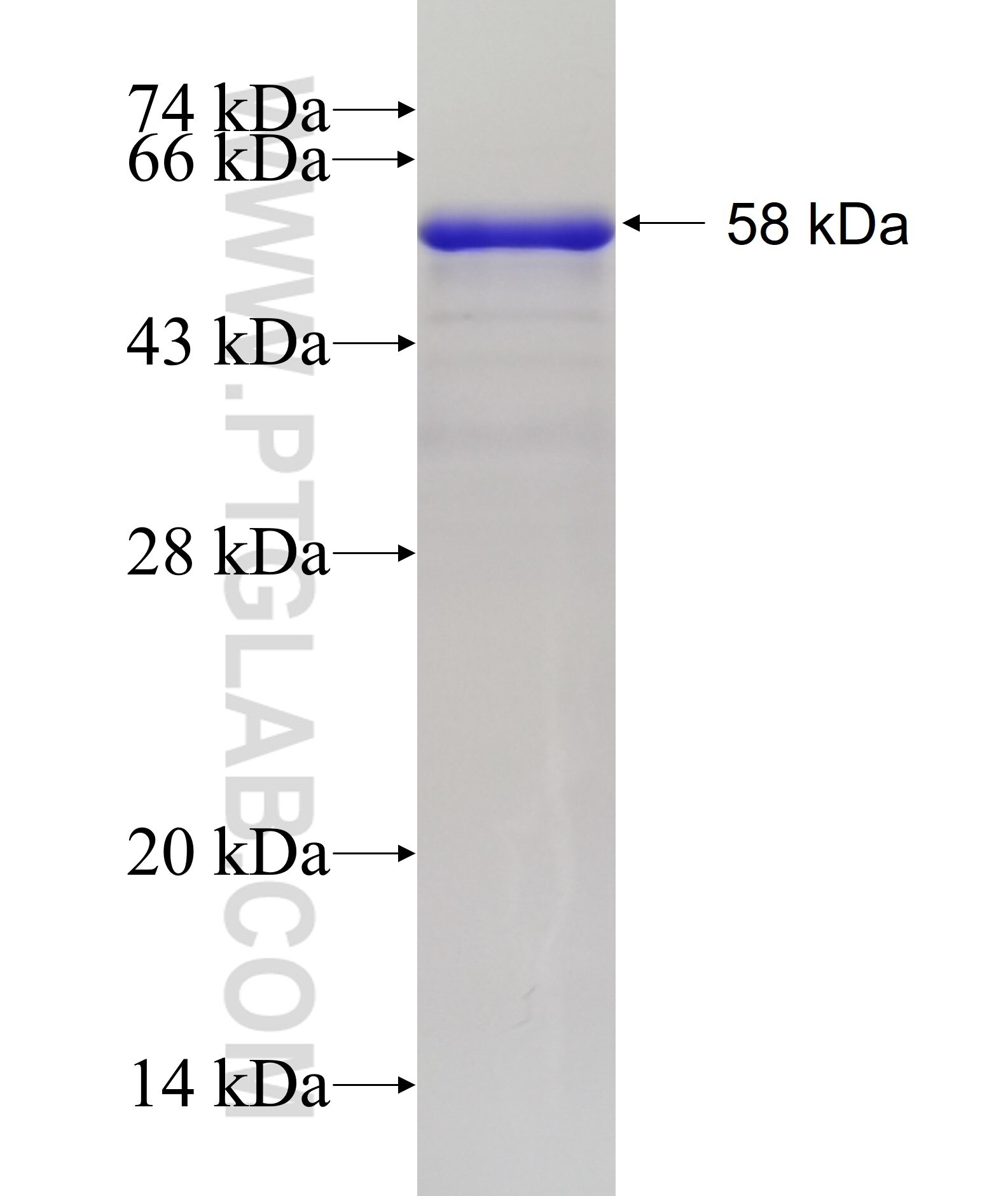 CEP162 fusion protein Ag32953 SDS-PAGE