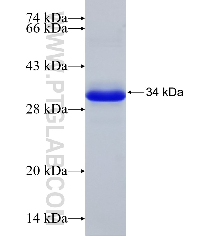 CEP162 fusion protein Ag33113 SDS-PAGE CEP162 fusion protein Ag33113 SDS-PAGE