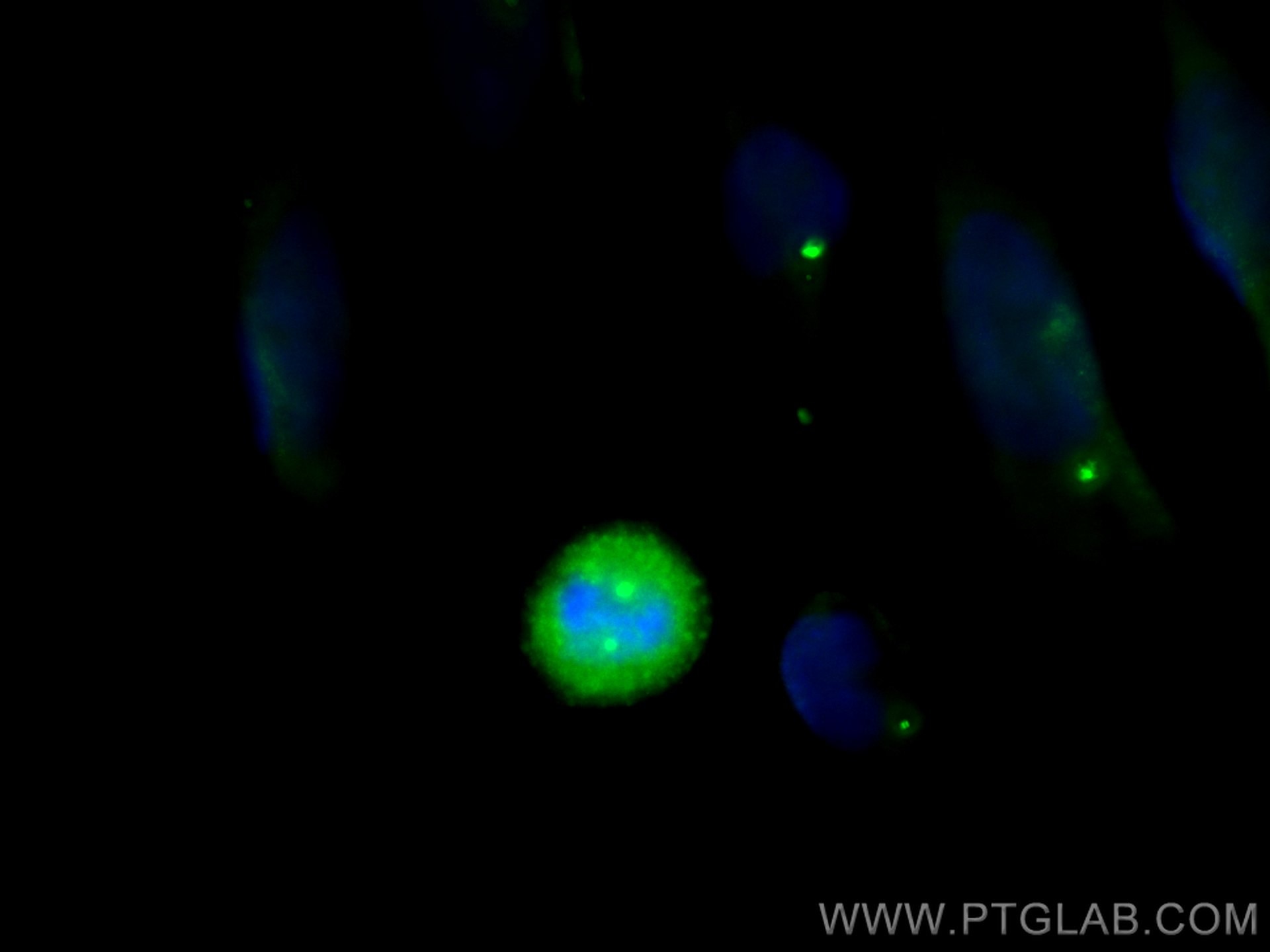 Immunofluorescence (IF) / fluorescent staining of HeLa cells using CEP164 Polyclonal antibody (22227-1-AP)