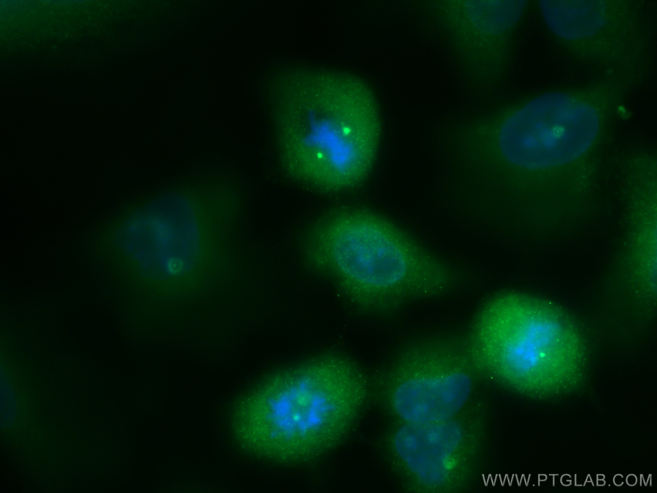 Immunofluorescence (IF) / fluorescent staining of A549 cells using CEP164 Polyclonal antibody (22227-1-AP)