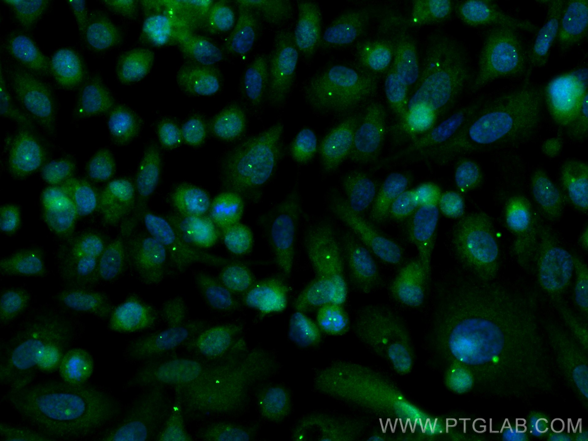 Immunofluorescence (IF) / fluorescent staining of PC-3 cells using CEP164 Polyclonal antibody (22227-1-AP)