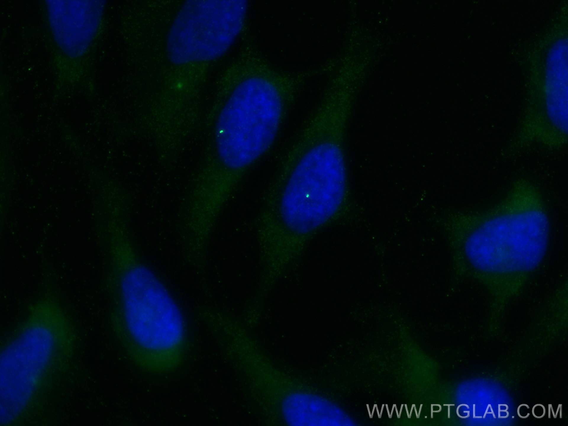 Immunofluorescence (IF) / fluorescent staining of HeLa cells using CEP164 Polyclonal antibody (22227-1-AP)
