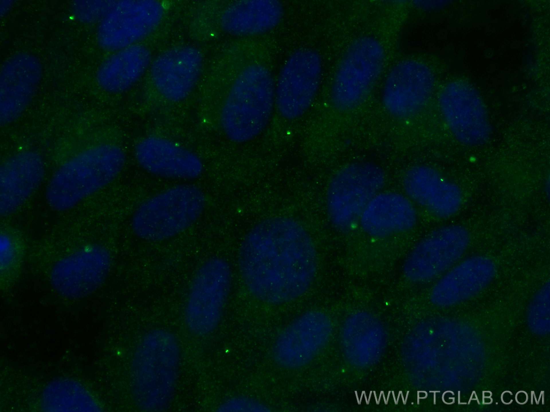 Immunofluorescence (IF) / fluorescent staining of hTERT-RPE1 cells using CEP164 Polyclonal antibody (22227-1-AP)