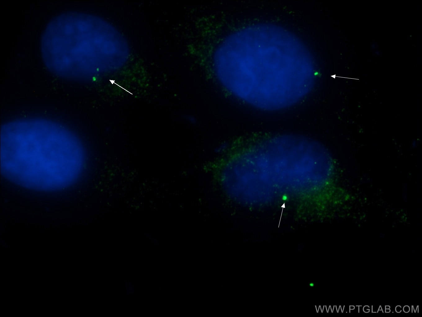 IF Staining of MDCK using 22227-1-AP