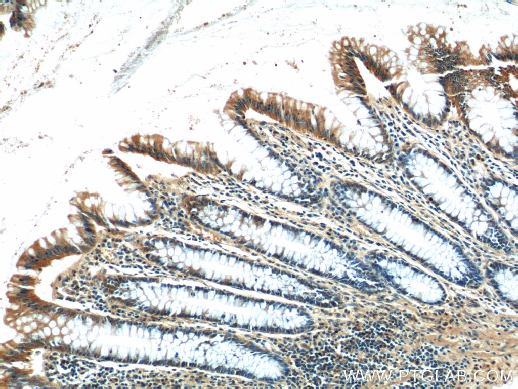 IHC staining of human colon using 22227-1-AP