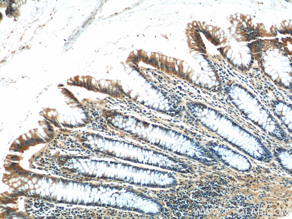 Immunohistochemistry (IHC) staining of human colon tissue using CEP164 Polyclonal antibody (22227-1-AP)