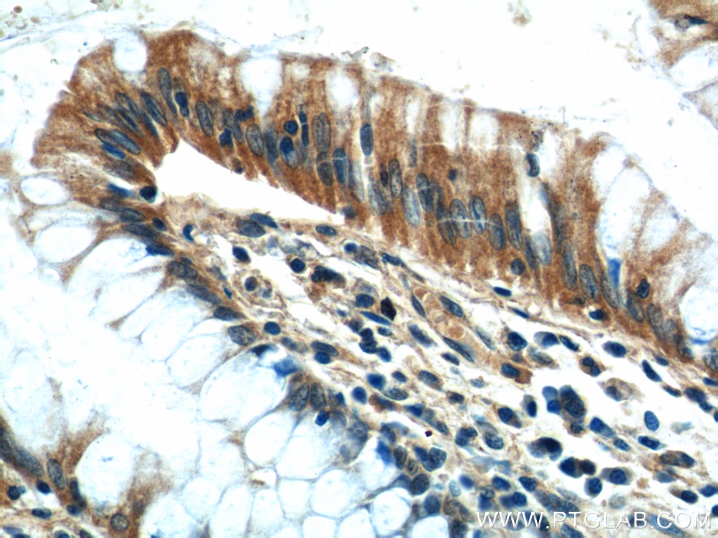 Immunohistochemistry (IHC) staining of human colon tissue using CEP164 Polyclonal antibody (22227-1-AP)