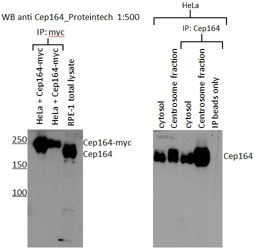 Immunoprecipitation (IP) experiment of RPE1 cells using CEP164 Polyclonal antibody (22227-1-AP)