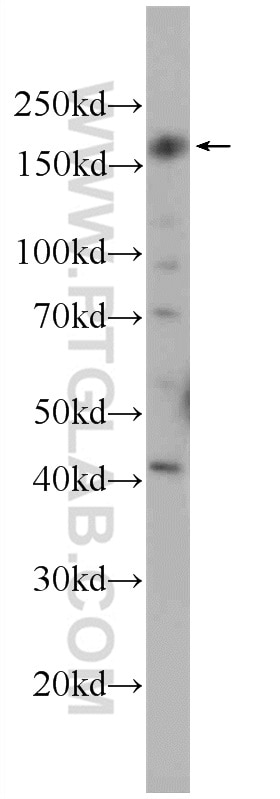 Western Blot (WB) analysis of HEK-293 cells using CEP164 Polyclonal antibody (22227-1-AP)