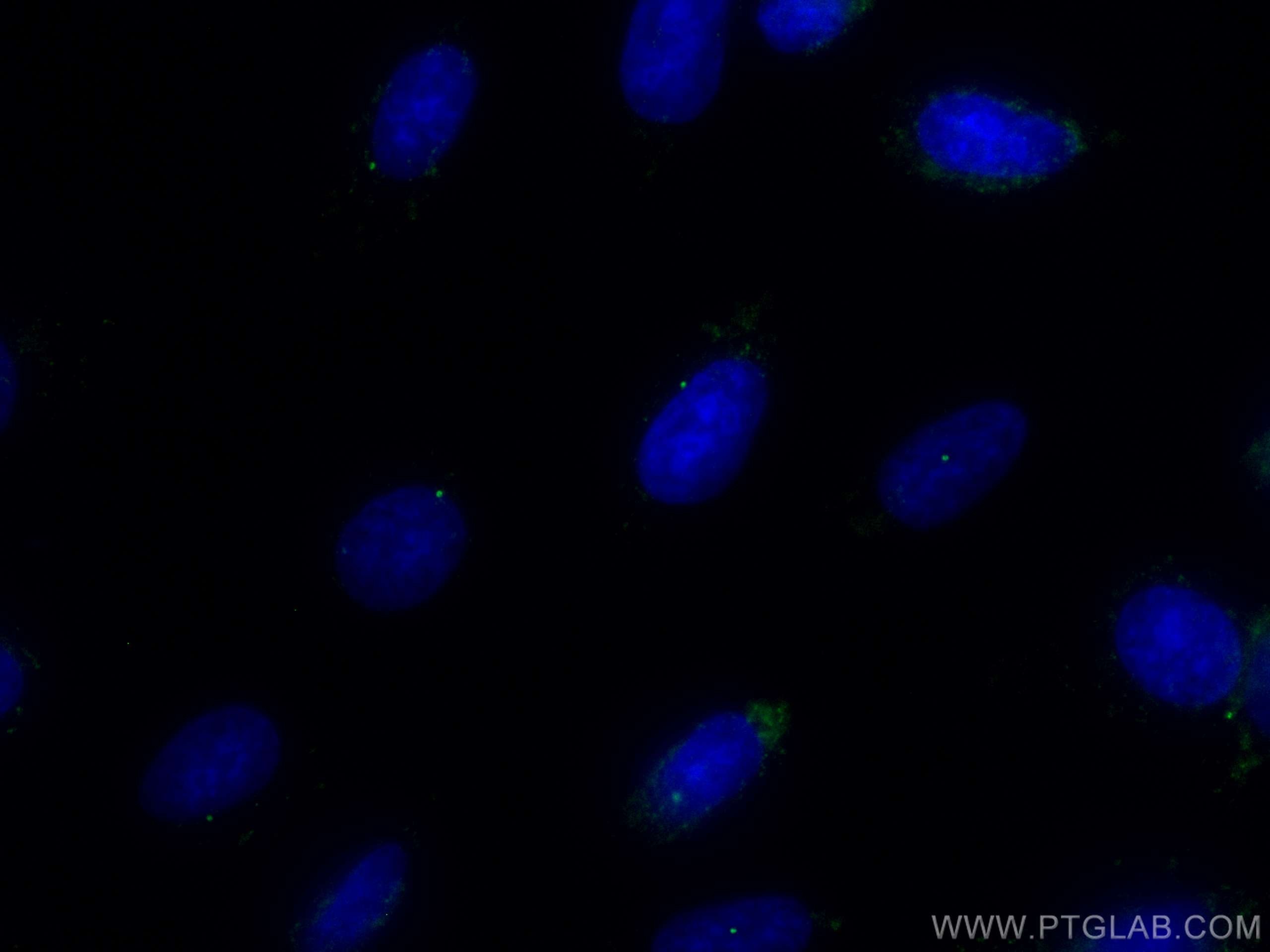 Immunofluorescence (IF) / fluorescent staining of MDCK cells using CoraLite® Plus 488-conjugated CEP164 Polyclonal an (CL488-22227)