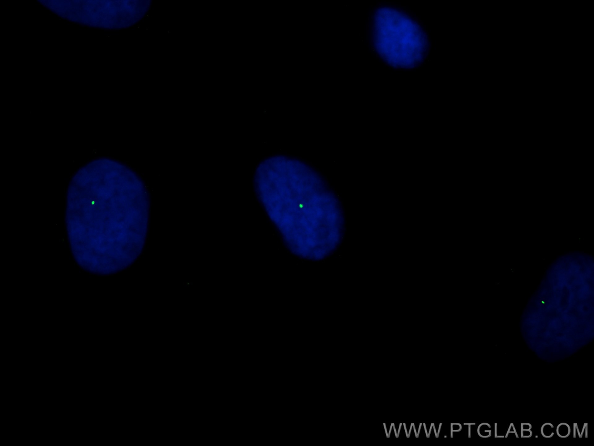 Immunofluorescence (IF) / fluorescent staining of HeLa cells using CoraLite® Plus 488-conjugated CEP164 Polyclonal an (CL488-22227)