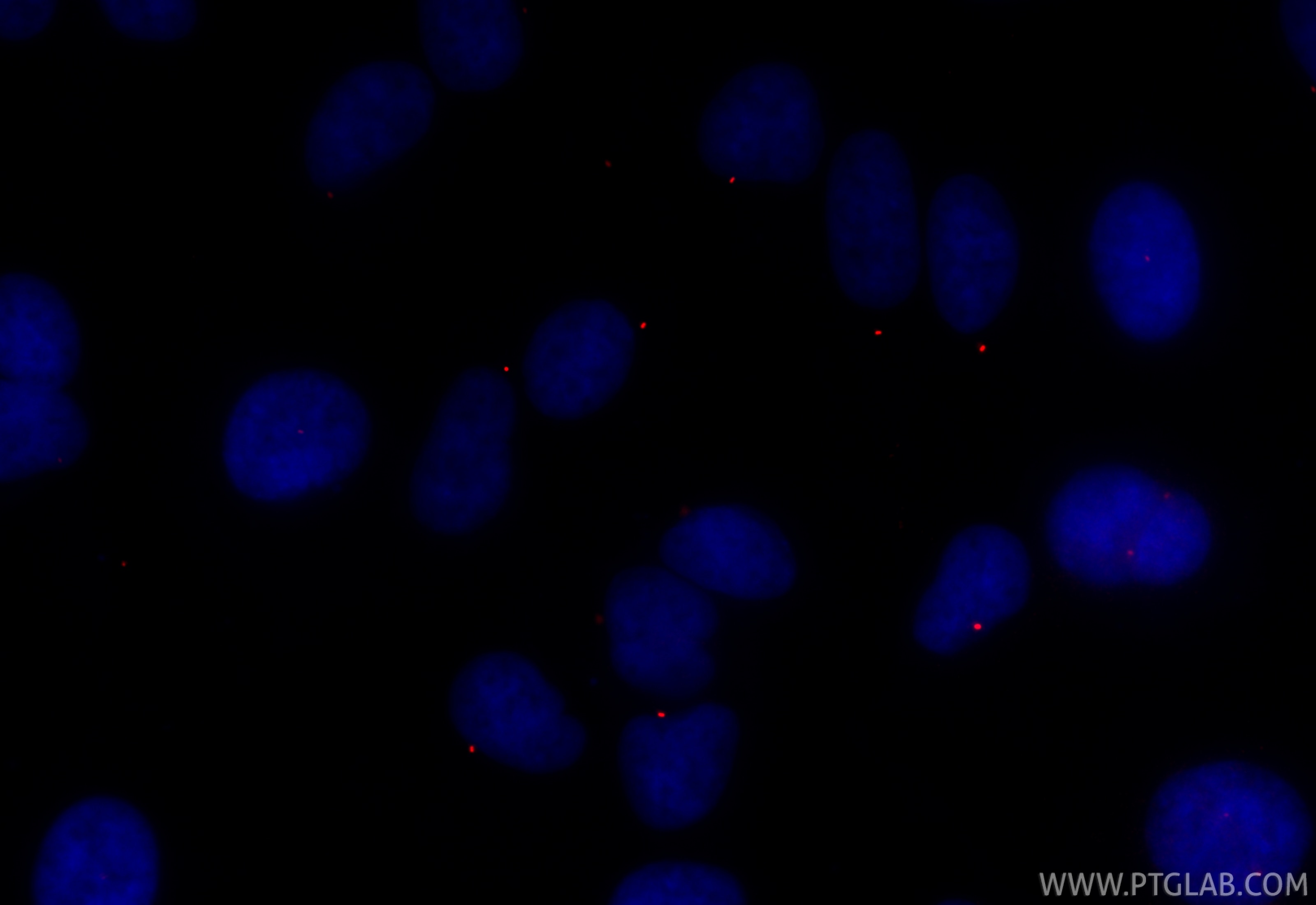 IF Staining of ARPE-19 using CL594-22227 Immunofluorescence (IF) / fluorescent staining of ARPE-19 cells using CoraLite®594-conjugated CEP164 Polyclonal antibody (CL594-22227)