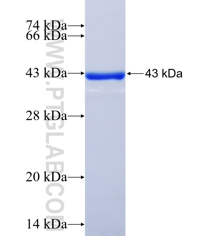 CEP164 fusion protein Ag17570 SDS-PAGE