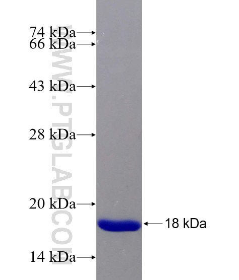 CEP164 fusion protein Ag17699 SDS-PAGE