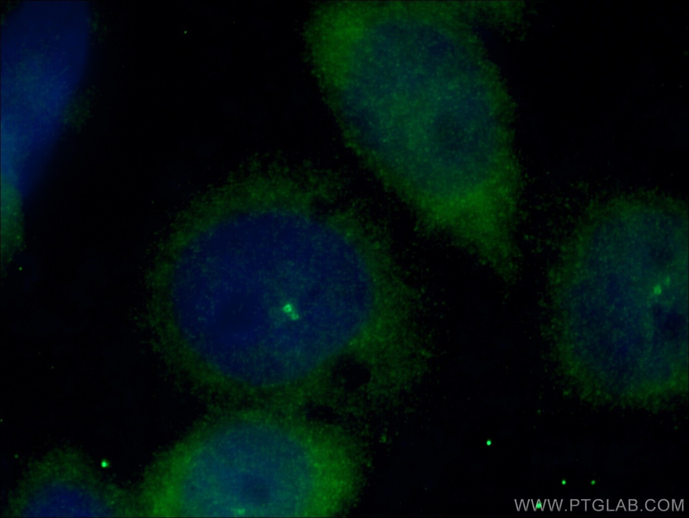 IF Staining of HeLa using 27325-1-AP