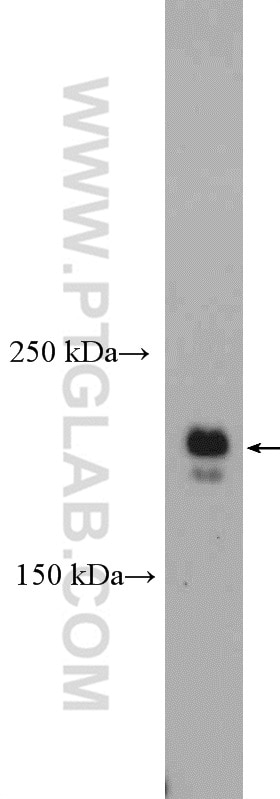 Western Blot (WB) analysis of HeLa cells using CEP170 Polyclonal antibody (27325-1-AP)