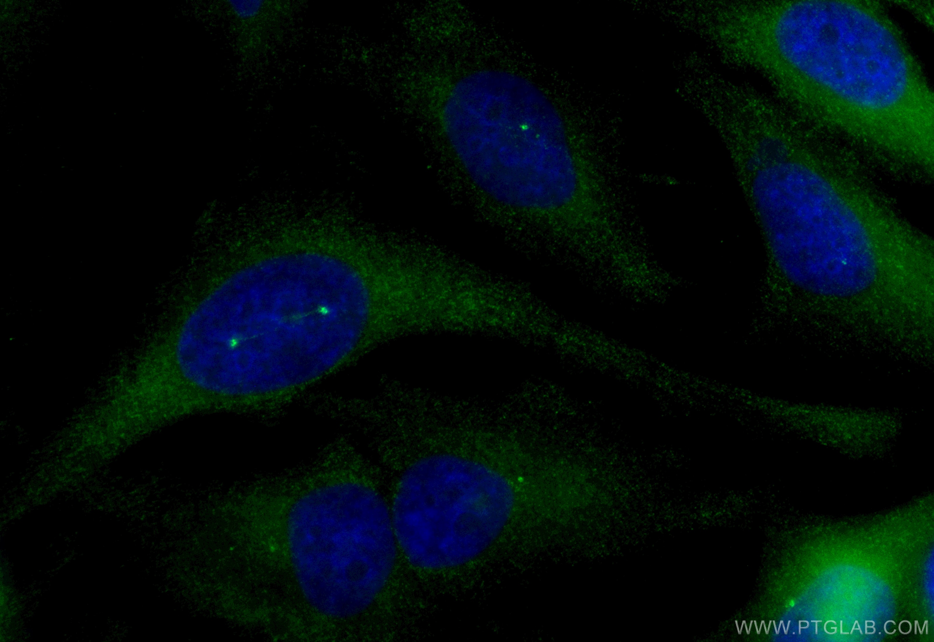 Immunofluorescence (IF) / fluorescent staining of HeLa cells using CoraLite® Plus 488-conjugated CEP170/CEP170L Polyc (CL488-18899)