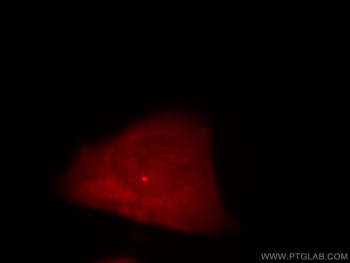 Immunofluorescence (IF) / fluorescent staining of HeLa cells using CEP170/CEP170L Polyclonal antibody (18899-1-AP)