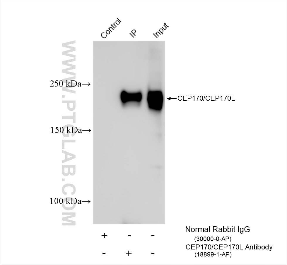 IP result of anti-CEP170/CEP170L (IP:18899-1-AP, 4ug; Detection:18899-1-AP 1:4000) with HeLa cells lysate 1480 ug. Immunoprecipitation (IP) experiment of HeLa cells using CEP170/CEP170L Polyclonal antibody (18899-1-AP)