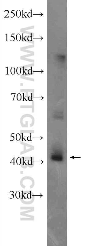 Western Blot (WB) analysis of mouse testis tissue using CEP170/CEP170L Polyclonal antibody (18899-1-AP)