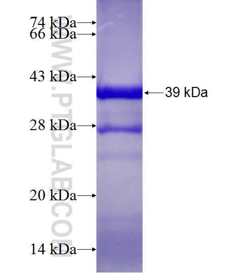 CEP170L fusion protein Ag13575 SDS-PAGE
